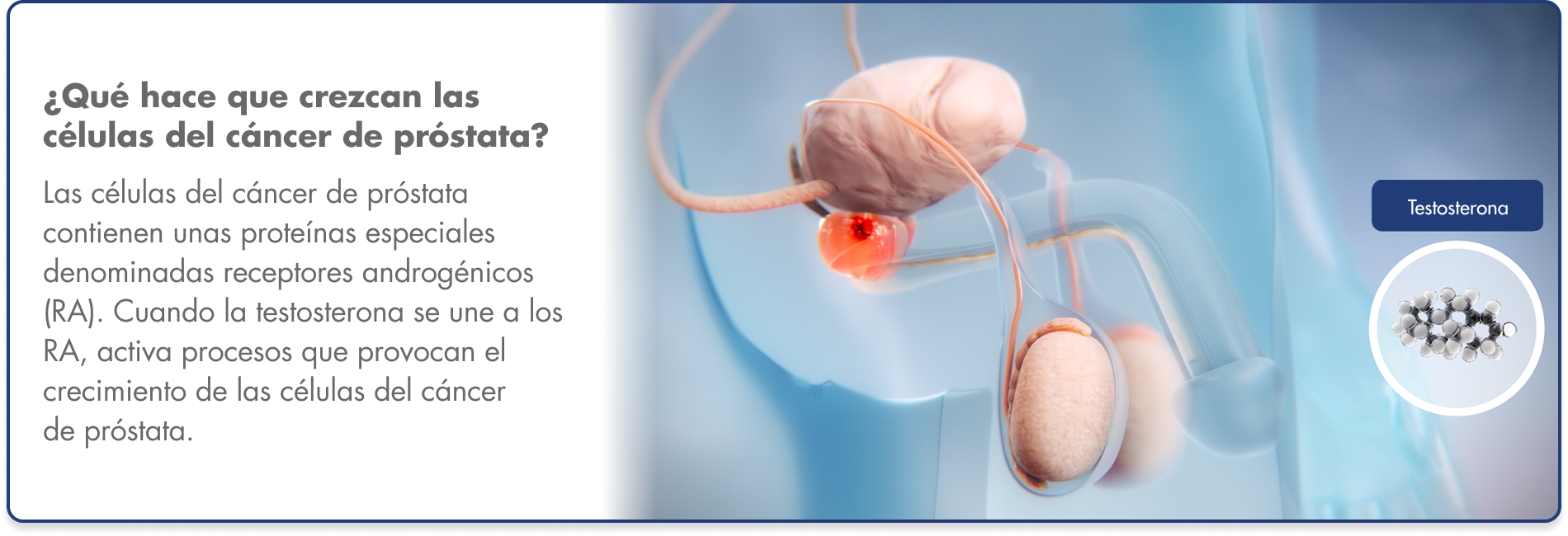 Interacción entre las células del cáncer de próstata y el receptor de andrógenos Gráfico de la unión de la testosterona a los receptores de andrógenos en las células del cáncer de próstata, lo que provoca que se multipliquen.