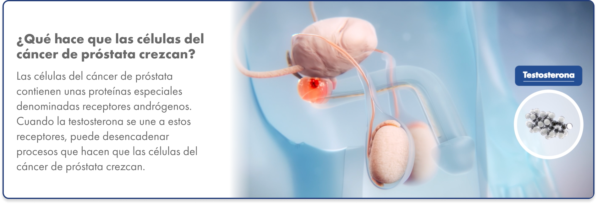Gráfico de la unión de la testosterona a los receptores de andrógenos en las células del cáncer de próstata, lo que provoca que se multipliquen.