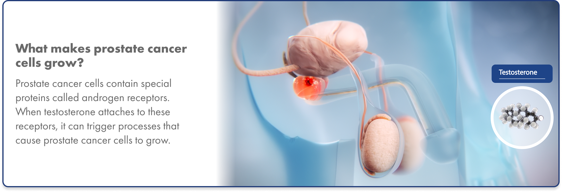 Graphic of testosterone binding to androgen receptors in prostate cancer cells, causing them to multiply
